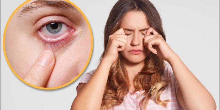 Eye Care Tips: जलन और चुभन से हैं परेशान? गर्मियों में आंखों को कूल रखने के लिए अपनाएं ये टिप्स