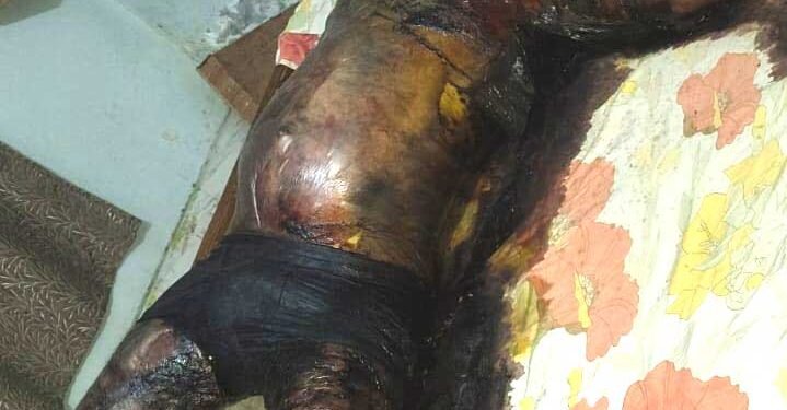 विधानसभा थाना क्षेत्र में संदिग्ध मौत, पोस्टमार्टम रिपोर्ट का इंतजार