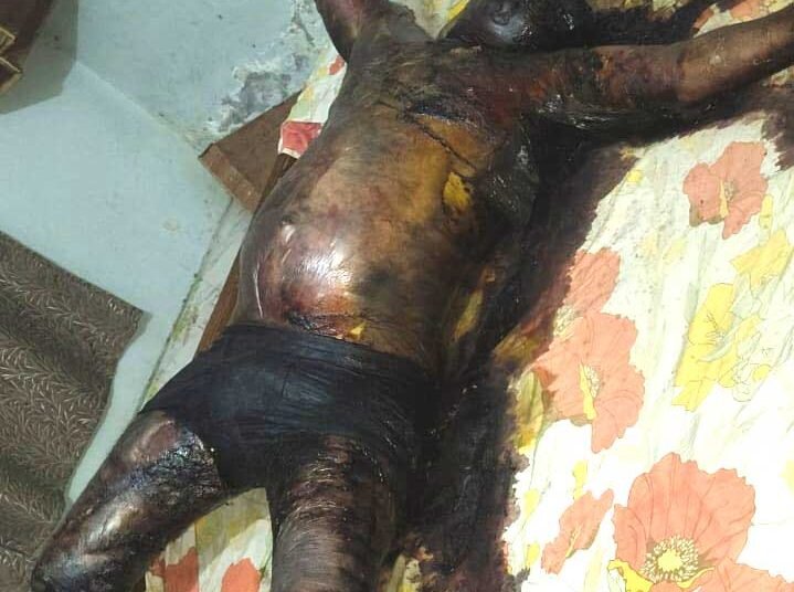 विधानसभा थाना क्षेत्र में संदिग्ध मौत, पोस्टमार्टम रिपोर्ट का इंतजार